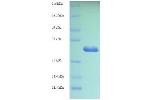 SDS-PAGE (SDS) image for Ionized Calcium-binding Adapter Molecule 1 (IBA1) (AA 2-147) protein (His tag) (ABIN7479055)