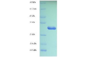 SDS-PAGE of protein expressed in E. (Iba1 Protein (AA 2-147) (His tag))
