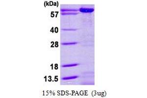 SDS-PAGE (SDS) image for Adenylate Kinase 5 (AK5) (AA 1-562) protein (His tag) (ABIN667970) (Adenylate Kinase 5 Protein (AK5) (AA 1-562) (His tag))