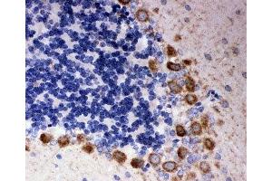 IHC-P: DISC1 antibody testing of rat cerebellum tissue