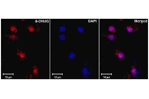 Immunohistochemistry analysis using Mouse Anti-DNA Damage Monoclonal Antibody, Clone 15A3 . (DNA/RNA Damage antibody (APC))