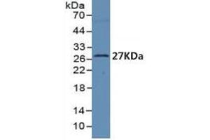 Western Blotting (WB) image for Brain-Derived Neurotrophic Factor (BDNF) ELISA Kit (ABIN6574127)