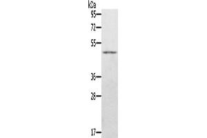 Western Blotting (WB) image for anti-Jumonji Domain Containing 5 (JMJD5) antibody (ABIN2423682) (JMJD5 antibody)
