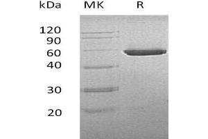 Western Blotting (WB) image for CNDP Dipeptidase 2 (Metallopeptidase M20 Family) (CNDP2) protein (His tag) (ABIN7320732) (CNDP2 Protein (His tag))
