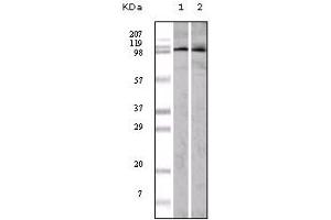 Western Blotting (WB) image for anti-Ephrin Type A Receptor 1 (EPHA1) (truncated) antibody (ABIN2464049) (EPHA1 antibody  (truncated))