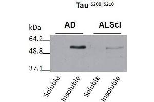 Western blot detection of insoluble phospho-Tau protein using the anti-Tau (Ser 208/210) antibody in samples isolated from patients with a neurodegenerative disease (Amyotropic lateral sclerosis, ALS or Alzheimer’s disease, AD (tau antibody  (pSer208, pSer210))