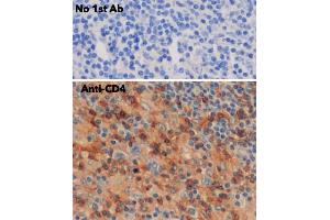 Immunohistochemistry (IHC) image for anti-CD4 (CD4) antibody (ABIN6254232)