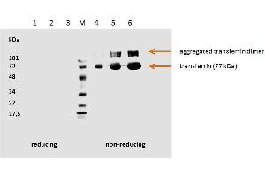 Human transferrin detected by the mouse monoclonal antibody HTF-14. (Transferrin antibody)