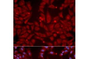 Immunofluorescence analysis of U2OS cells using GRIK2 Polyclonal Antibody (GRIK2 antibody)