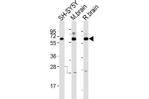 All lanes : Anti-DPYSL5 Antibody (C-term) at 1:2000 dilution Lane 1: SH-SY5Y whole cell lysates Lane 2: mouse brain lysates Lane 3: rat brain lysates Lysates/proteins at 20 μg per lane. (DPYSL5 antibody  (C-Term))