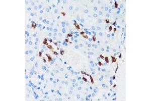 Immunohistochemistry of paraffin-embedded mouse kidney using V1G3 antibody (ABIN7265759) at dilution of 1:100 (40x lens). (ATP6V1G3i antibody  (AA 1-118))