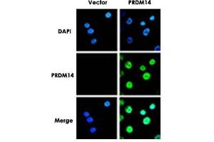 Immunofluorescence analysis of PRDM14 in breast cancer cells. (PRDM14 antibody  (N-Term))