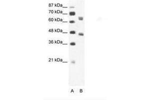 Image no. 1 for anti-RRN3 RNA Polymerase I Transcription Factor (RRN3) (AA 331-380) antibody (ABIN202852) (RRN3 antibody  (AA 331-380))