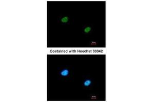 ICC/IF Image Immunofluorescence analysis of paraformaldehyde-fixed A431, using RBBP5, antibody at 1:200 dilution. (RBBP5 antibody  (Center))
