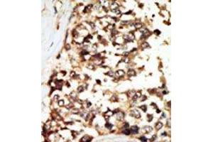 Image no. 2 for anti-Protein Kinase D2 (PKD2) (C-Term) antibody (ABIN360330) (PKD2 antibody  (C-Term))