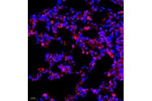 Immunofluorescence of paraffin embedded rat pneumonia using CCR2 (ABIN7073453) at dilution of 1:800 (400x lens)