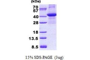 CIAPIN1 Protein (His tag)