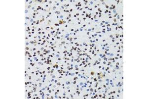 Immunohistochemistry (Paraffin-embedded Sections) (IHC (p)) image for anti-Nuclear Factor of kappa Light Polypeptide Gene Enhancer in B-Cells 2 (NFKB2) (AA 690-899) antibody (ABIN3017388)