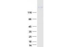 Validation with Western Blot (WNK4 Protein (Myc-DYKDDDDK Tag))