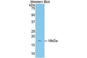 Western blot analysis of the recombinant protein. (TCF20 antibody  (AA 1656-1792))