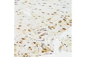 Immunohistochemistry of paraffin-embedded human stomach using EFTUD2 Antibody (ABIN5974236) at dilution of 1/100 (40x lens). (EFTUD2 antibody)