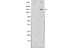 Western blot analysis of NMDAR2B expression in A549 whole cell lysates,The lane on the left is treated with the antigen-specific peptide. (GRIN2B antibody  (C-Term))