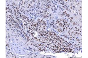 IHC analysis of YY1 using anti-YY1 antibody (ABIN7603001).