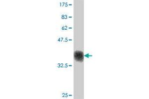 Western Blotting (WB) image for anti-Integrin beta 3 (ITGB3) (AA 27-136) antibody (ABIN561552)
