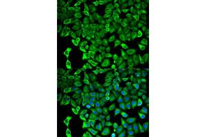 Immunofluorescence (IF) image for anti-Proteasome (Prosome, Macropain) 26S Subunit, Non-ATPase, 2 (PSMD2) antibody (ABIN1874389) (PSMD2 antibody)