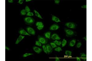 Immunofluorescence of monoclonal antibody to HARS on HeLa cell. (HARS1/Jo-1 antibody  (AA 1-96))