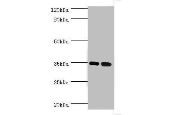 MAGEA6 antibody  (AA 75-314)