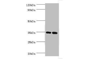 Western blot All lanes: MAGEA6 antibody at 7 μg/mL Lane 1: Rat brain tissue Lane 2: Rat gonad tissue Secondary Goat polyclonal to rabbit IgG at 1/10000 dilution Predicted band size: 35 kDa Observed band size: 35 kDa (MAGEA6 antibody  (AA 75-314))