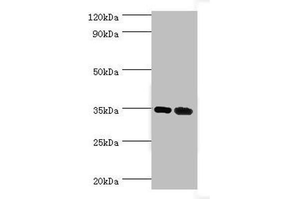 MAGEA6 Antikörper  (AA 75-314)