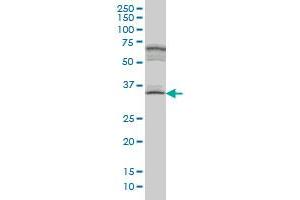 MYOZ1 monoclonal antibody (M05A), clone 1E8. (Myozenin 1 antibody  (AA 200-298))