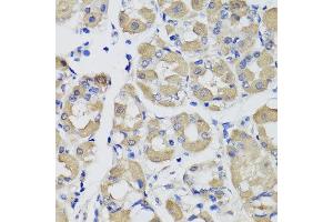 Immunohistochemistry of paraffin-embedded human gastric using PSPH antibody at dilution of 1:100 (x40 lens). (PSPH antibody)