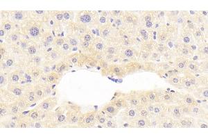 Detection of C9 in Mouse Liver Tissue using Polyclonal Antibody to Complement Component 9 (C9) (C9 antibody  (AA 136-512))