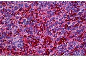 Human Spleen: Formalin-Fixed, Paraffin-Embedded (FFPE) (XCL1 antibody  (AA 22-114))