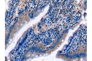 Detection of C5a in Rat Small intestine Tissue using Monoclonal Antibody to Complement Component 5a (C5a) (C5A antibody  (AA 1-77))