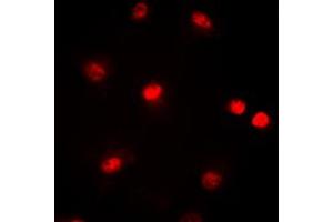 Immunofluorescent analysis of CBP staining in HeLa cells. (CBP antibody  (Center))