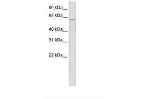 Image no. 1 for anti-Zinc Finger Protein 426 (ZNF426) (AA 70-119) antibody (ABIN202755) (ZNF426 antibody  (AA 70-119))