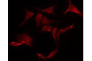 ABIN6275305 staining HeLa by IF/ICC. (CHRNA10 antibody  (C-Term))
