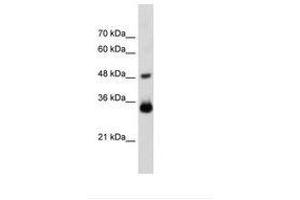 Image no. 1 for anti-Homeobox C9 (HOXC9) (AA 151-200) antibody (ABIN203517) (HOXC9 antibody  (AA 151-200))