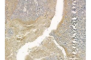 ABIN6258102 and ABIN6273682 at 1/100 staining human normal tonsil tissue by IHC-P. (Keratin 36 antibody  (Internal Region))