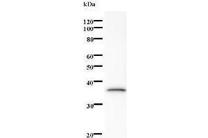 Western Blotting (WB) image for anti-SUMO1 Activating Enzyme Subunit 1 (SAE1) antibody (ABIN931206) (SAE1 antibody)