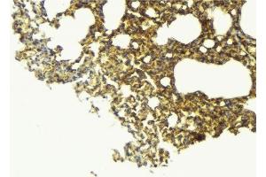 Immunohistochemistry (IHC) image for anti-Sodium Channel, Nonvoltage-Gated 1, beta (SCNN1B) (C-Term) antibody (ABIN6264946)