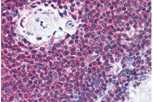 Human Spleen (formalin-fixed, paraffin-embedded) stained with MIF antibody ABIN305887 at 5 ug/ml followed by biotinylated anti-mouse IgG secondary antibody ABIN481714, alkaline phosphatase-streptavidin and chromogen. (MIF antibody  (AA 1-114))