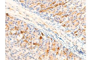 Immunohistochemistry (IHC) image for anti-serum/glucocorticoid Regulated Kinase 1 (SGK1) (pSer422) antibody (ABIN6256329)