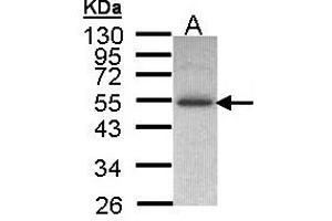 Image no. 1 for anti-Inositol Hexakisphosphate Kinase 2 (IP6K2) (AA 15-200) antibody (ABIN467499) (IP6K2 antibody  (AA 15-200))