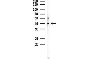 Western blot analysis of lysates from Mouse brain, using VPS72 Antibody at 1/1000 dilution.