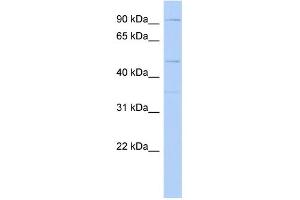 WB Suggested Anti-DPY19L2 Antibody Titration: 0.